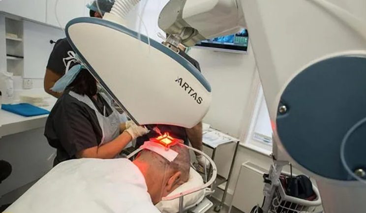 ARTAS® robotic hair restoration device